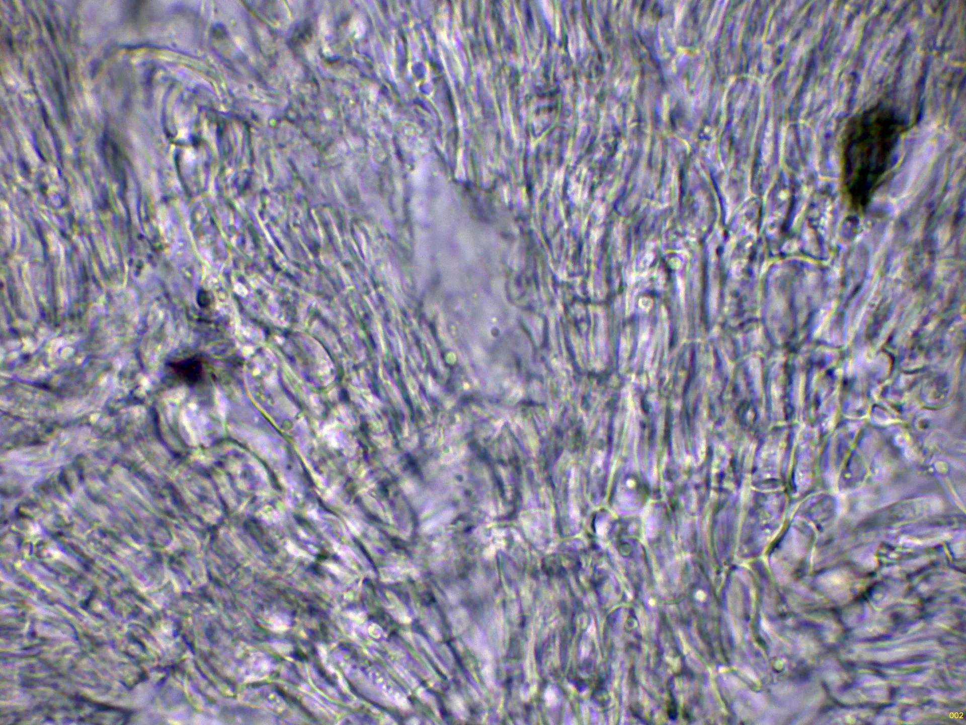15 - Excípulo agua-002